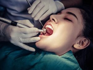 Root canal treatment in newcastle