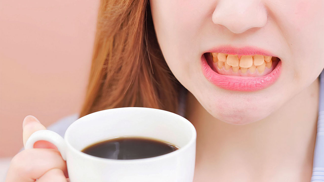 coffee-stains-teeth