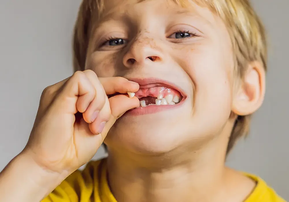 When Kids Lose Baby Teeth Early