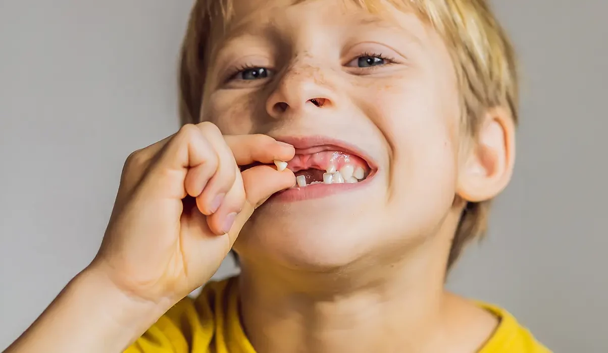 When Kids Lose Baby Teeth Early