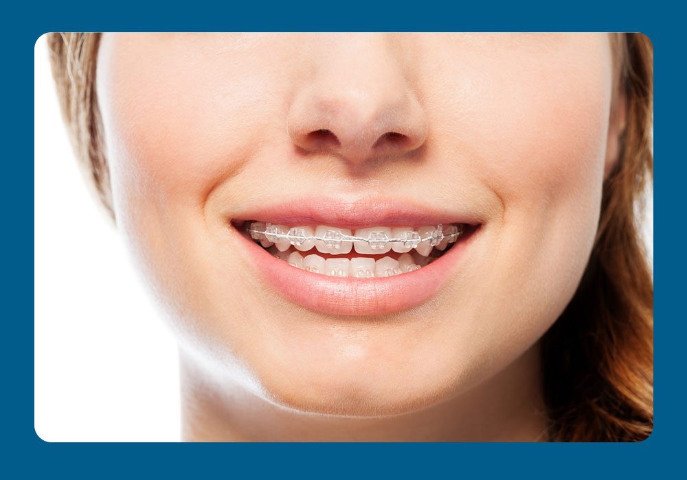 When Is the Right Time for Braces