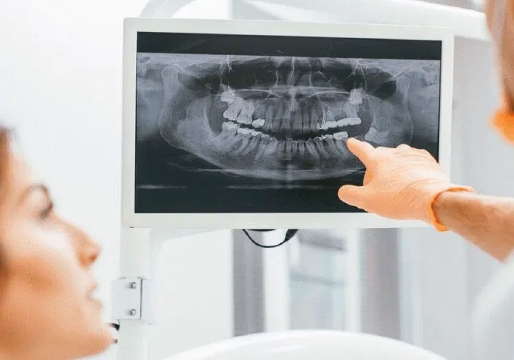 Dental X-Rays Safe